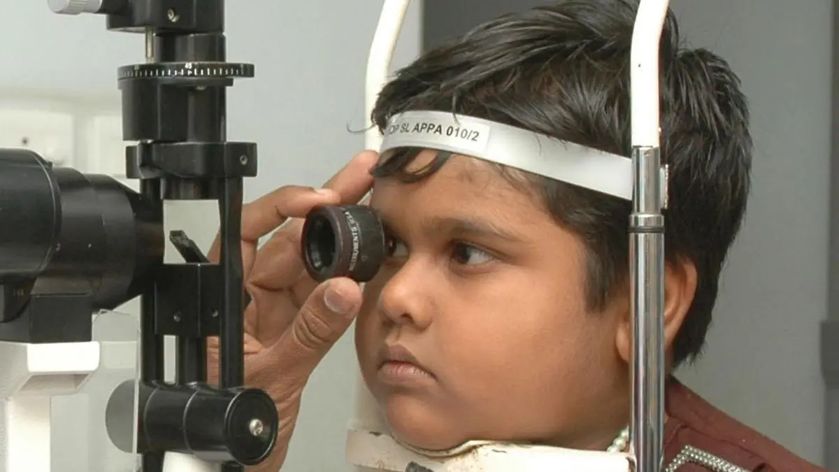 Lazy eye in children often goes undetected, say doctors