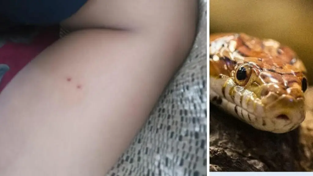 Snake bites Class 3 student inside Kolkata school washroom