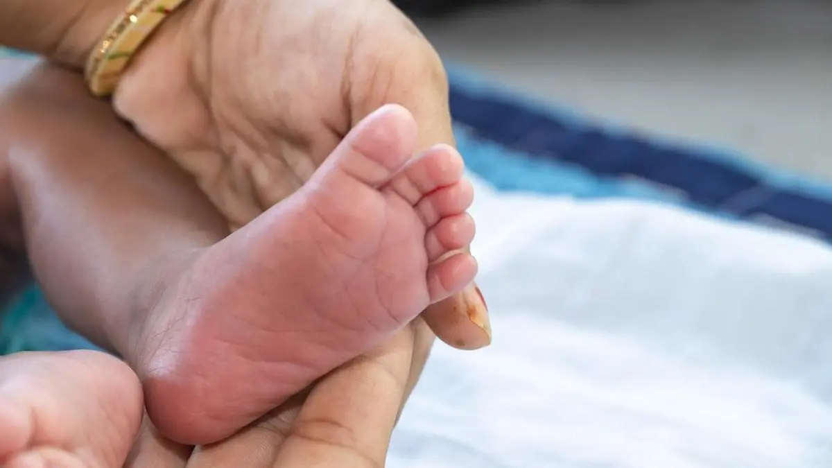 Genetic tests missing for intersex babies in Tamil Nadu hospitals