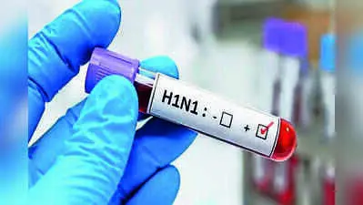 Telangana reports zero swine flu cases as Karnataka crosses 4,000