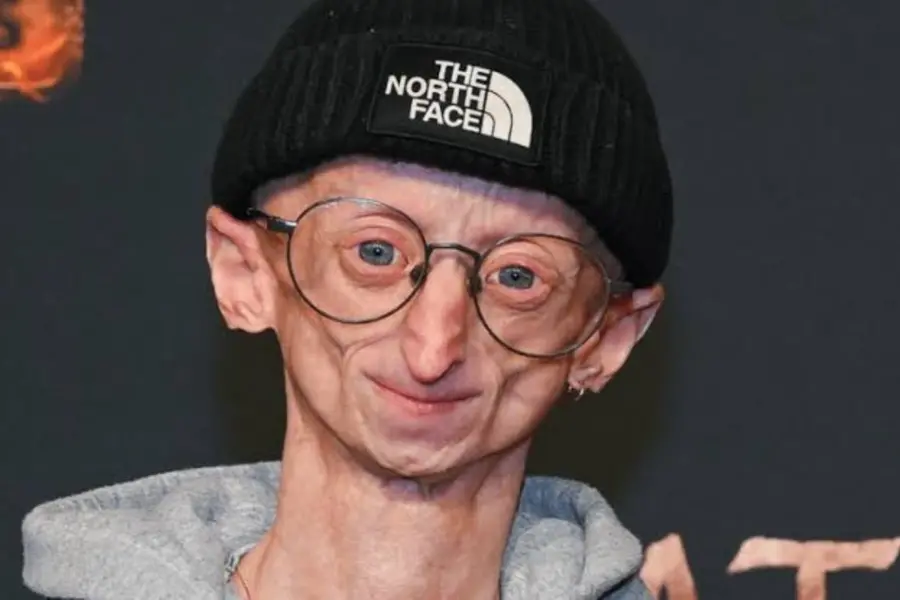 Progeria advocate Michiel Vandeweert dies at 28