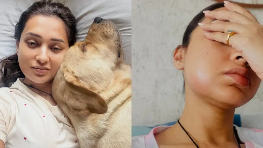 Mimi Chakraborty shares swollen face photos after tooth surgery