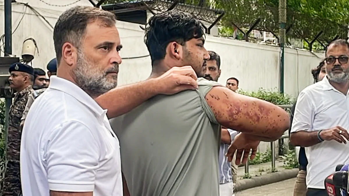 AIIMS refuses RTI details on Jantar Mantar pellet injuries: Gokhale