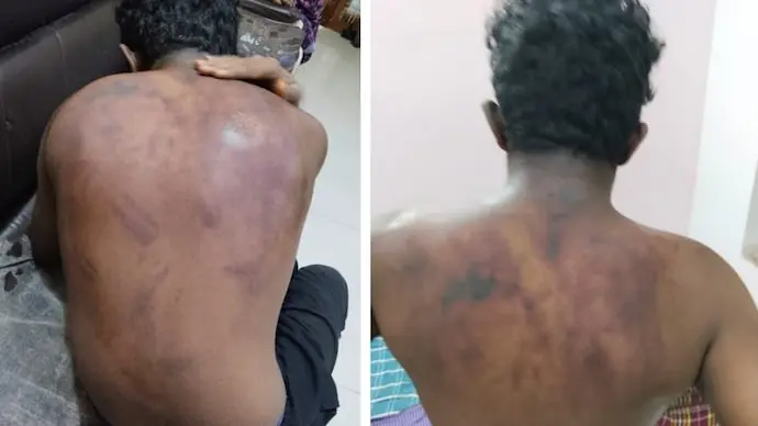 Telangana Class 10 student hospitalised after hostel assault by 12 seniors