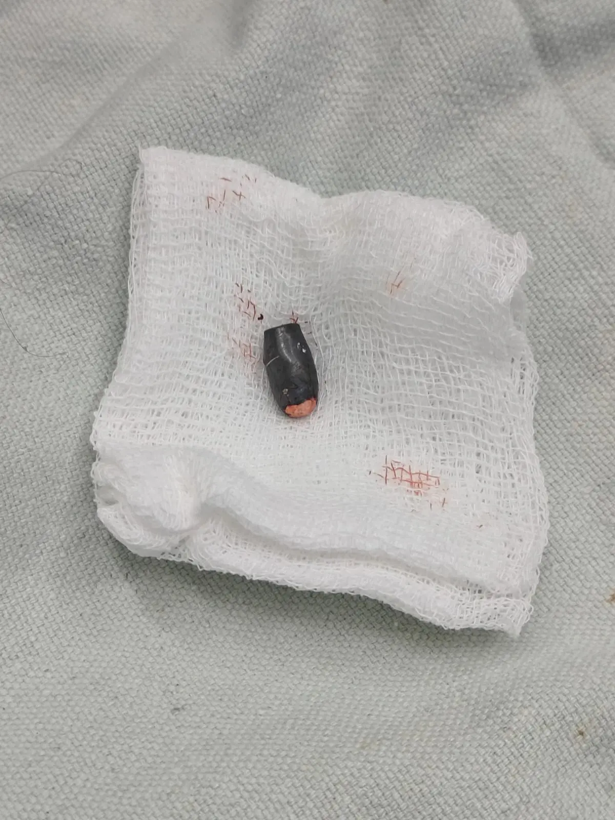 Bullet removed from Tiger Shroff firing victim at KEM Hospital