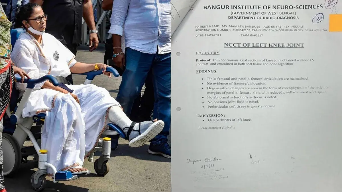 Mamata Banerjee medical report leak: legal notice sent to three doctors